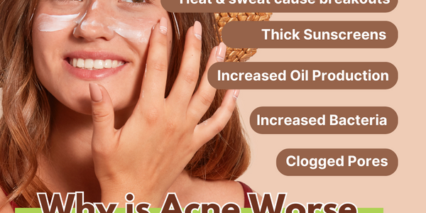 WHY IS ACNE WORSE IN THE SUMMER?