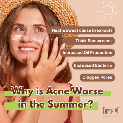 WHY IS ACNE WORSE IN THE SUMMER?